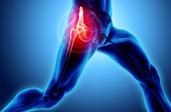 Total Hip Joint